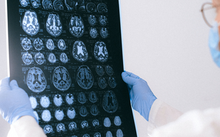 What Are the Benefits of Prioritizing Preventive Imaging?