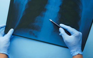 Can Preventive Imaging Save Lives? Exploring Its Impact.