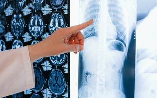 Why is Preventive Imaging Vital for Early Disease Detection?