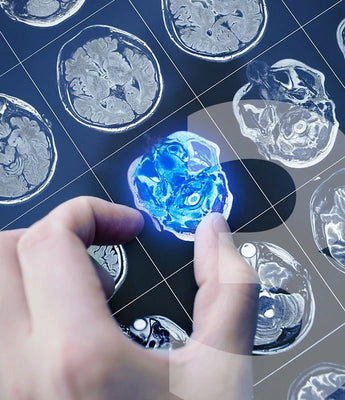 Step 3 Imaging Assessment