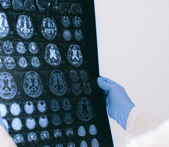 What Are the Benefits of Prioritizing Preventive Imaging?