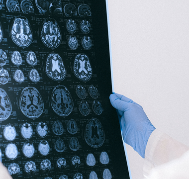 What Are the Benefits of Prioritizing Preventive Imaging?