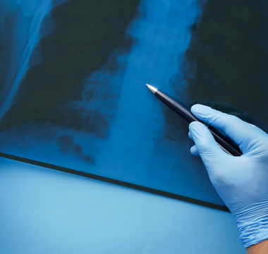 Can Preventive Imaging Save Lives? Exploring Its Impact.