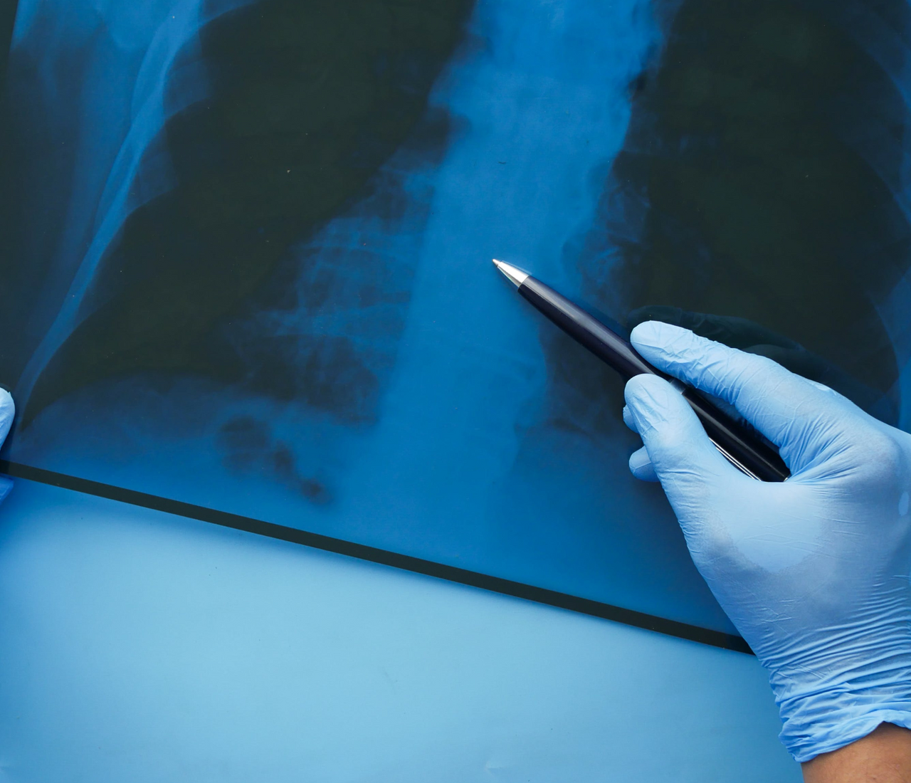 Can Preventive Imaging Save Lives? Exploring Its Impact. LifeAmore