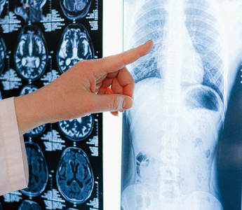 Why is Preventive Imaging Vital for Early Disease Detection?