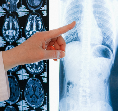 Why is Preventive Imaging Vital for Early Disease Detection?